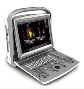 Chison Eco 6 Top Tier Economy Portable Ultrasound Unit